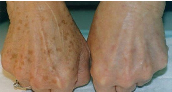 ��� ���������� �� ���������� �����