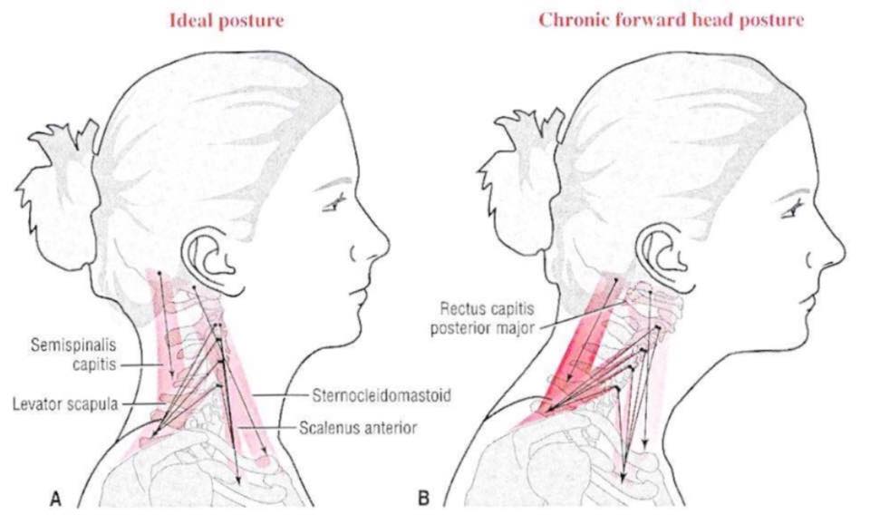 ������ �� ����� ������