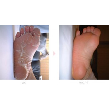  ������� ��� � ��������? ��������? ���! ����������! B@by-foot-20. ��� ��������� ������������ ���������. ������� �����, ���� �����. ���������� ������� 8 �����, ���� �� 170 ������. ���� ������� ����������� �������� � �������!