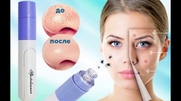 ���� �������! ��� �����������! ��������� ���������� ���!