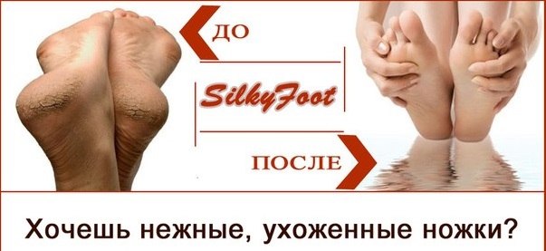 Silky - �������� � ������ �� �������!