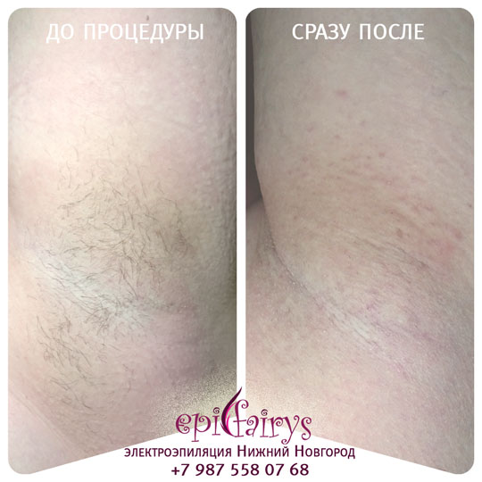 ��������������� ����������� �������