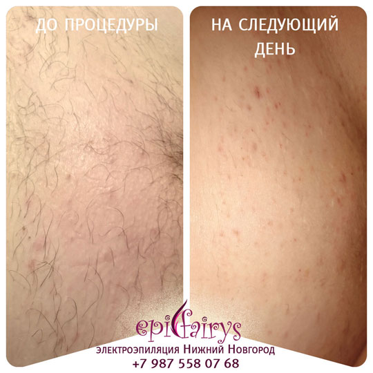 ��������������� ���� ������