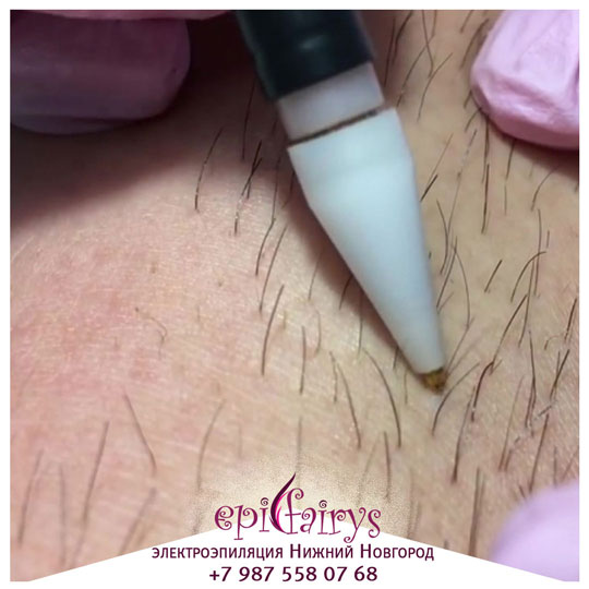 ��������������� � ������ ���������