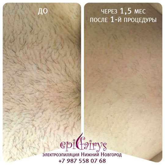 ��������������� ���� ������ ����� 1,5 ������ ����� ������ ���������