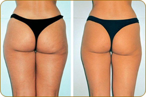 ������. ��������. ���������, ����������� �����. 