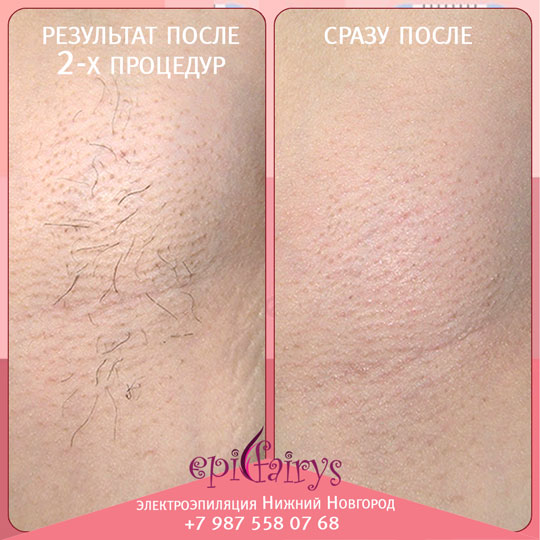 ��������� 2-� �������� ��������������� � ������� ��������