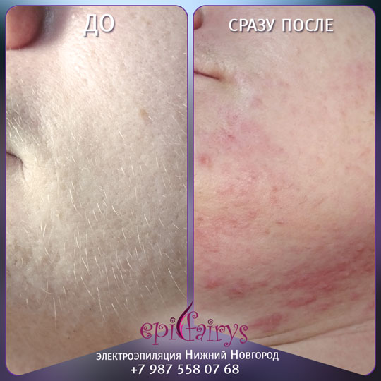 ��������������� �� ����. ��������� � ������ ������ � ���������� ���������...