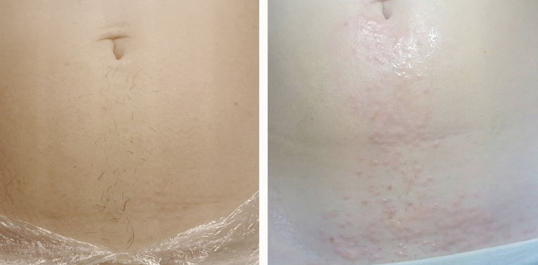 ��������������� ������