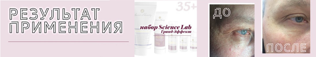 �.�.�.�.�.� �.�.�.�.�.�.� � �.�.�.�.�.�.�.� � ����� �������! ���������� ���������, ���������� ������. �������! ����� ��� ����� �� ����� Science lab. Premium care - ������ �� Sederma(�������).