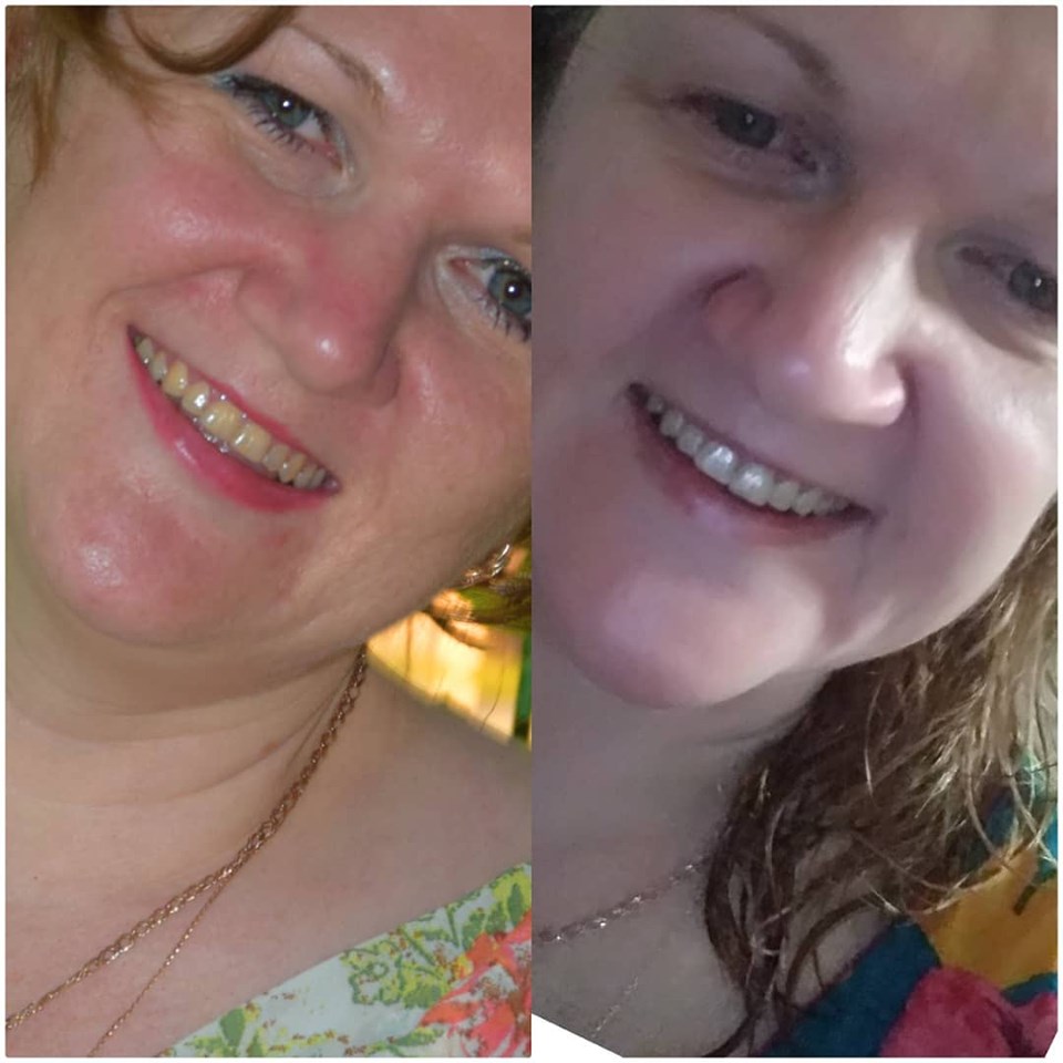 ���������� ������ ����� NL!!! �������� ������������ ������!!!