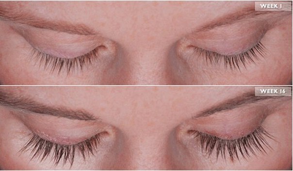 Careprost � Carelash - ������ ��������� � �������! ���� ������� ������ �������, ���� � ������ ����� 4-6 ������ ����� ������ �������������. ����� - 113