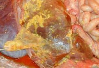 ������ ���������