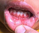 ������ ��������