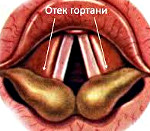 ���� �������