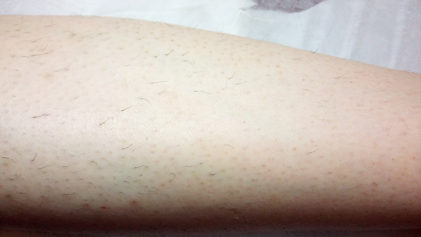 ����� ���� �����.