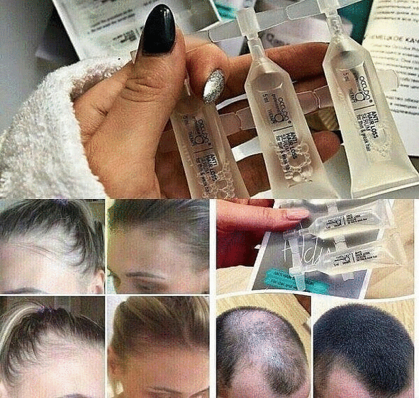 �������� � ��������??? ������ ��� ����� �����!