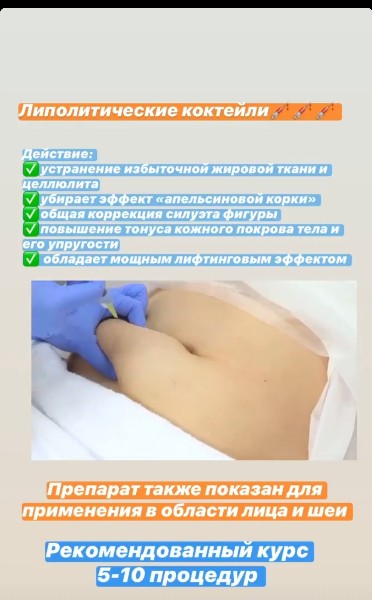 �������(���������)