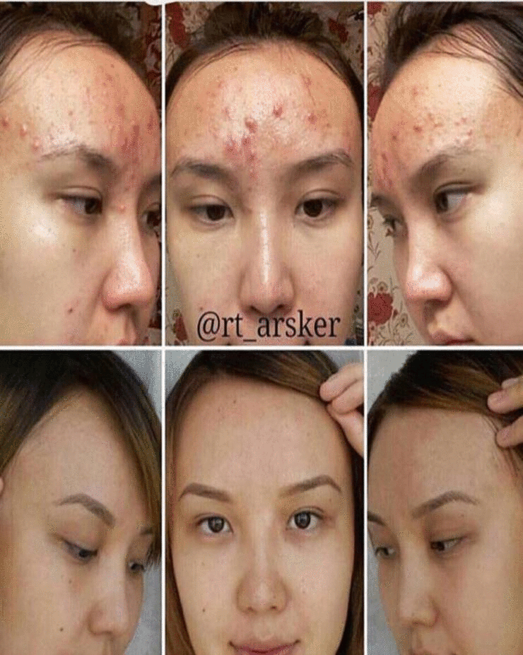 ��� ���� ����� ������� ��������?