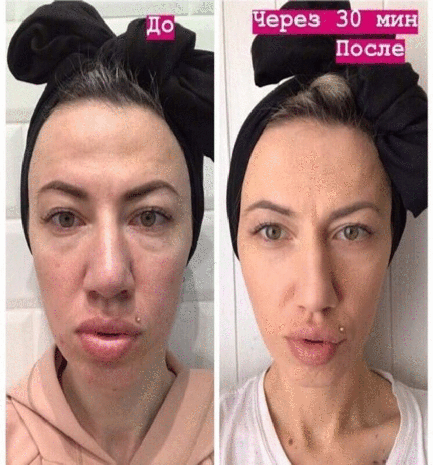 �������� ����� 1 ��� ���, ��� ����� ��������, � ��� �� ���������� �� ������ � ������ ��������! ��� �� �����, ��� ��� �������?