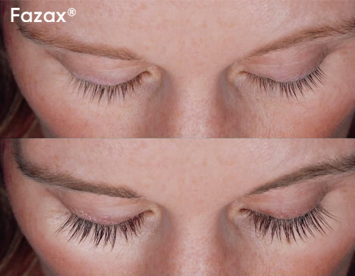 �������� ��� ���������� ����� ������ Fazax (Depixil 20%). 3 ��