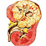 �������-��������� ���