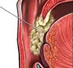 ��� ������