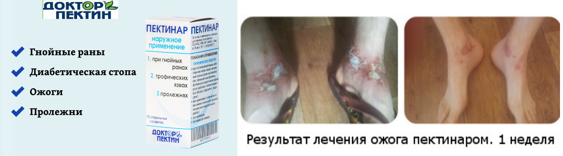 �������� ���������� � ������ ��� ������, ������� �����, ��������, ������. �������� - ������������� �� �������� �����.