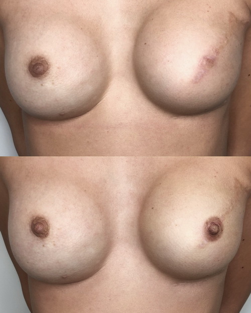 ����� �����: ������ ����� ����������� �������� ����� ������ ������ - ��� ��������?