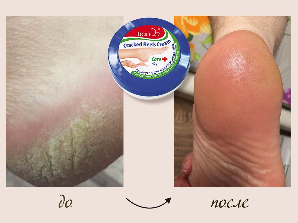 ��������� � �������� ����� 2-� �������: �� Yves Rocher, �� Tian*De, + ���-�������� ��� ������.  