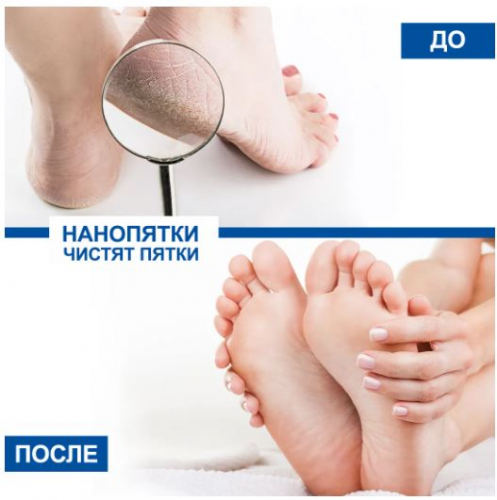 [b]��� �� ������ - �� ������� ������! ����������� ��������� Bodyton � ��������� - 39 [/b]