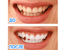 otbelivatel-zubov-white-lig.png