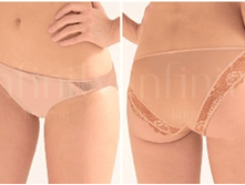 158932 126 �������