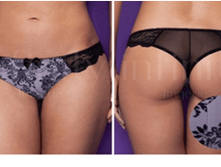 221231 �������