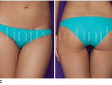 051130C ���������