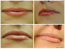 ����� ��� ��� H*y*dra Lip Bo*os*ter, ��� No28/���. ����