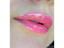 ����� ��� ��� H*y*dra Lip Bo*os*ter, ��� No55/���. ����
