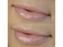 ����� ��� ��� H*y*dra Lip Bo*os*ter, ��� No28/���. ����