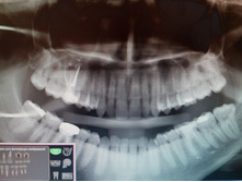 IMG 20161124 175603.jpg