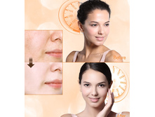 � ��������