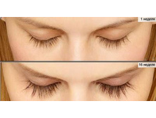 Careprost 3 ��  - ������ ��������� � �������! - 222