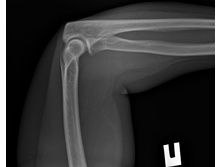 14725 35021 20180125184532.0.jpg