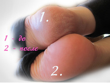 ����������� ������� ��� ����� HEEL PROTECTOR ���� 250 � -1.jpg