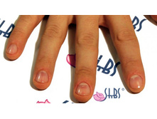 ������� �������