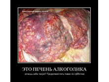 1302164206_4rum3s3s61oh.jpg