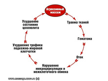 ������� 20 (����� �������������� ������������ �������)